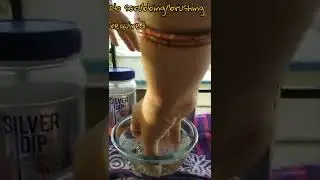 Modicare Silver dip live result 🤩|| #shorts