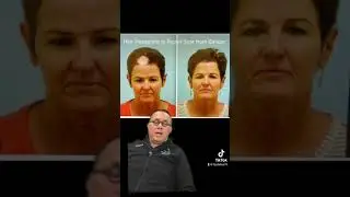 Dallas Hair Surgeon Talks about a Reconstructive Hair Transplant Case