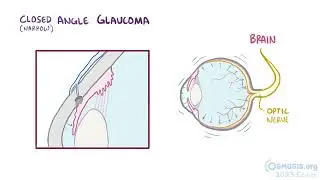 15 4 Eyes, ears, nose, and throat Pathology Eyedisorders