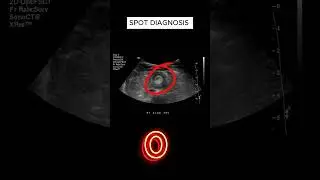 X ray quiz 37 #nursing #nursingstudent #doctor #USMLE  #MBBS, #hospital #anatomy  #ctscan #radiology