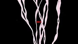 Harvey James - SMACK (Official Video)