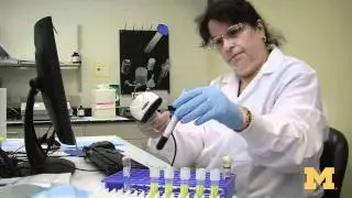 Urine test shows prostate cancer risk