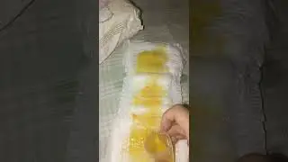 maternity pads after delivery🤰 maternity pads after delivery review maternity pads for new moms 