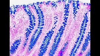 Alcian Blue stain to detect acidic polysaccharides glycosaminoglycans and mucopolysaccharide
