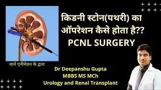 PCNL explained in Hindi I PCNL FOR KIDNEY STONE I percutaneous nephrolithotomy |Kidney stone surgery