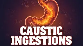 Module 25.1 - Caustic Ingestions - Introduction