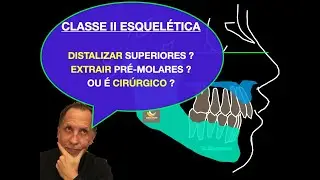 COMO CORRIGIR A CLASSE II ESQUELÉTICA? DISTALIZAÇÃO; EXTRAÇÃO OU CIRURGIA?