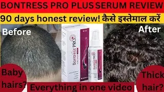 Bontress pro plus scalp serum honest review// 90 days before and after results #hairfall