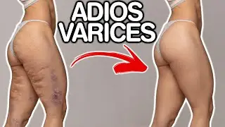 PIERNAS CANSADAS | Remedios y consejos