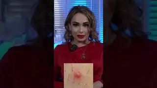 Qinda ugrilar nima sababdan chiqadi ?