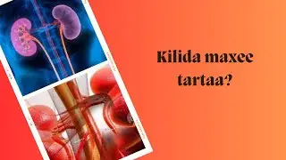 Maxaa dhacayo haddii kilida lagaa bixiyo