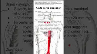 Acute aortic dissection