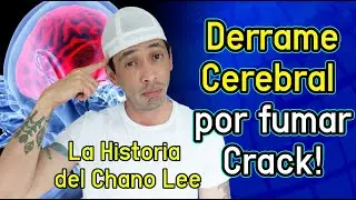 Tuvo un Derrame y No Par&oacute; de Usar ... - La Historia del Chano Lee.