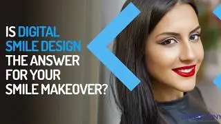 Is Digital Smile Design the Answer to Your Smile Makeover in Dubai?
