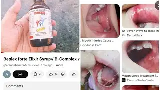 Beplex forte Elixir Syrup// B-Complex with Vitamin C and  Lysine // DOSES PRICE SIDE-EFFECT REVIEW 