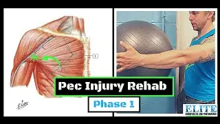 Pec Injury Rehab - Phase 1 | Case Study