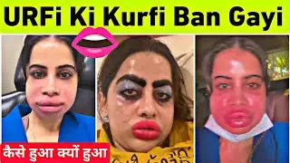 Urfi Javed Lips Surgery | Urfi Javed Lip Filler Video | Urfi Javed New Look Lips Viral Video