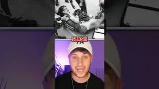 Самая жуткая футбольная травма в истории 😭 &mdash; Эвальд Линен