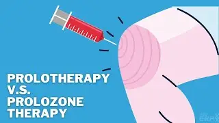 Prolotherapy V.S. Prolozone Therapy: What is the difference and which one is for you?