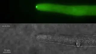 Spitzenk&ouml;rper in filamentous fungus, Neurospora crassa.