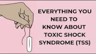 Toxic Shock Syndrome | toxic shock syndrome toxin | toxic shock syndrome staphylococcus aureus