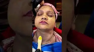 Yellow peel treatment