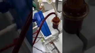 Plasmapheresis