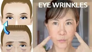 Stubborn Eye Wrinkles? Try This Natural Face Yoga Routine 👀✨