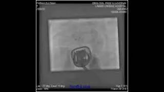 Fariha Sultana 1 Y 10 M  10 Kg,ASD device closure done 12 mm Cocoon