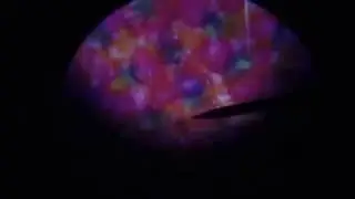 300X Magnification Microscope