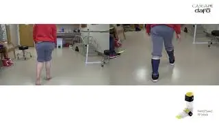 Before and After | Strong toe walking | DAFO Tami2