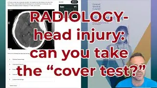 RADIOLOGY FOR MED STUDENTS: head injury diagnosis on CT
