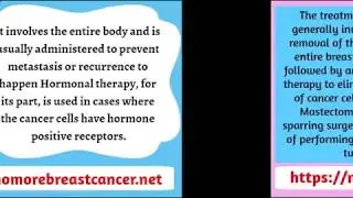 Stage Wise Treatment Options for Breast Cancer