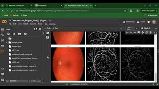 Retinal image classification Code Demo