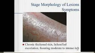 11:30-13:00 Лекция 3 Eczema Ngema M V