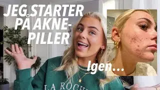 EN SNAK OM AKNE: Isotretinoin, min historie & starter igen!