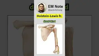 Holstein Lewis Fracture Causing Wrist Drop