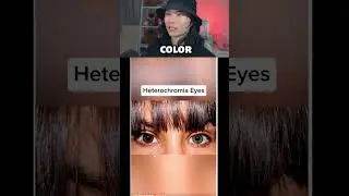 Редчайшие генетические особенности человека...