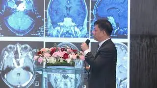 S2 | Dr. Tran Huy Hoan Bao, Cho Ray Hospital | Neurosurgical Oncology in Cho Ray Hospital