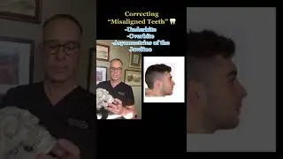 Jaw Surgery