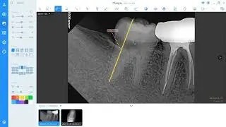 របៀបប្រើប្រាស់កម្មវីធី​ Smartdent V3 by CDS