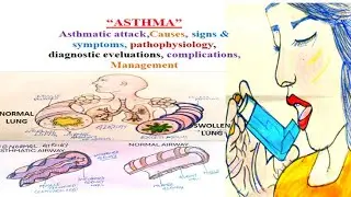 [Asthma Nursing Care Plan: Detailed Pathophysiology, Symptoms, and Management in Hindi 💯]