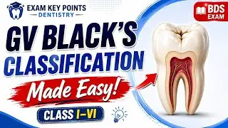 GV Black's Classification of Dental Caries |Conservative Dentistry|BDS Exam Key Points 