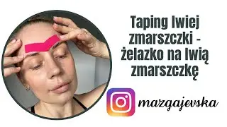Jak pozbyć się lwiej zmarszczki? Facetaping estetyczny twarzy!
