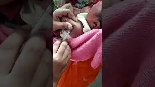 BCG vaccination💉 #babycare #injection #bcg