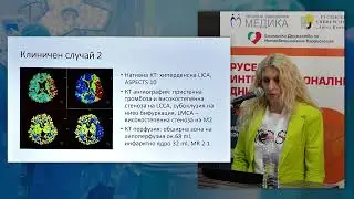11. Новости в лечението на ИМИ и представяне на клинични случаи