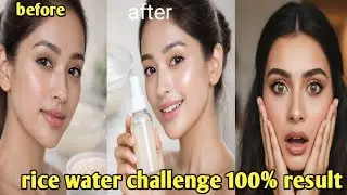 7 Days Rice Water Challenge 😱 Glass Skin Naturally | Dark Spots & Pigmentation Gone