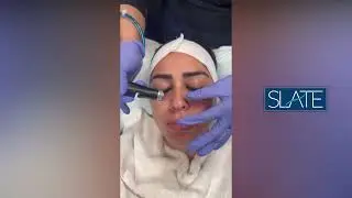 Diamond Facial Experience in New Jersey | Slate Medspa