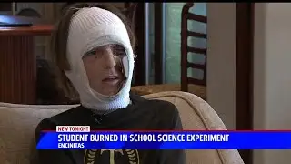 Student Burned in School Science Experiment