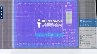 Meridian DPA - Demo of Arterial Stiffness - report